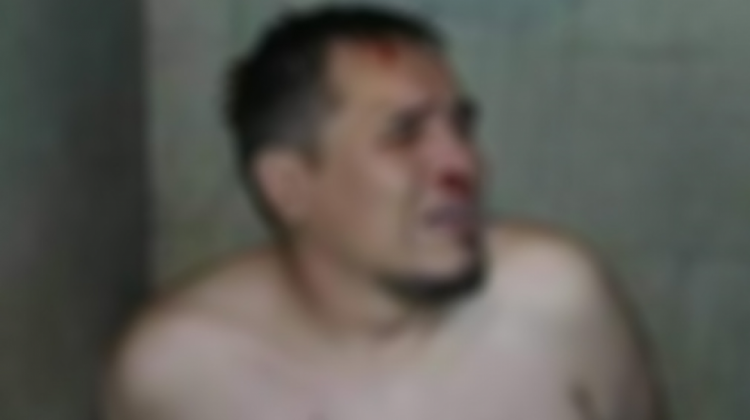Circulan fotografías en redes sociales sobre supuesta tortura al abogado Jhasmani Torrico.