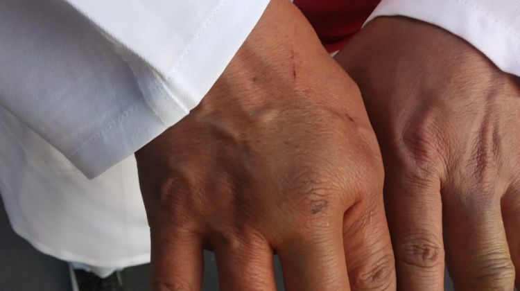 Uno de los médicos muestra sus heridas después del enfrentamiento con afines al MAS. Foto: Colegio Médico de La Paz.