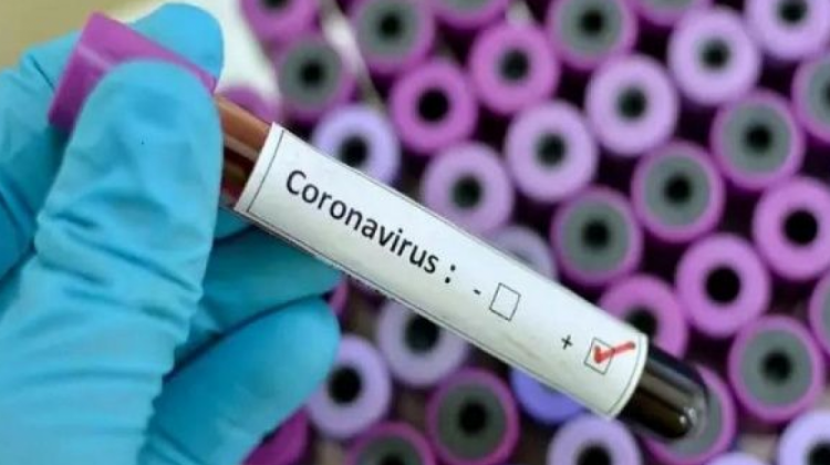 Imagen ilustrativa de un análisis de coronavirus. Foto: Internet.