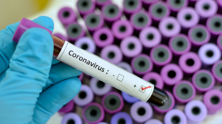 Exámenes de coronavirus. Foto: Internet.