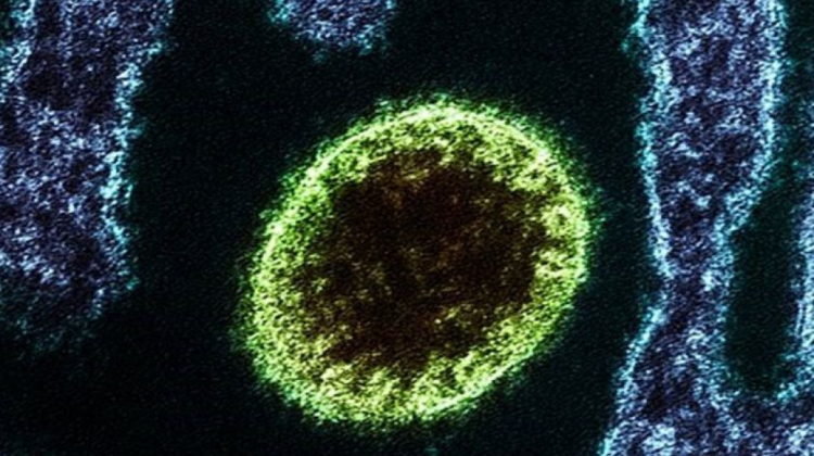 El henipavirus Nipah, de la misma familia que el virus Langya. Foto: CEDOC