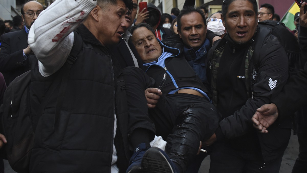 Una de las personas heridas en la toma militar. Foto: ABI