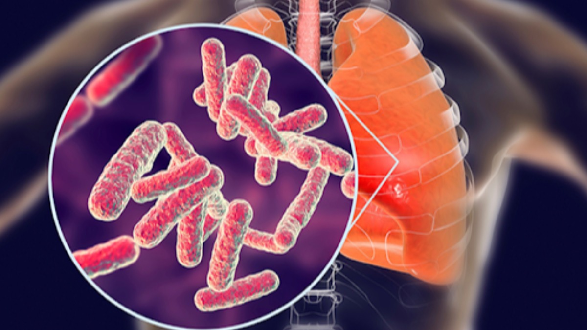 Recreación de la bacteria Mycobacterium tuberculosis que causa la infección pulmonar.